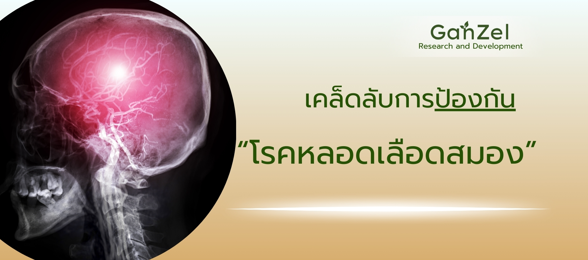 หลอดเลือดสมอง โรคสมอง ปวดหัว