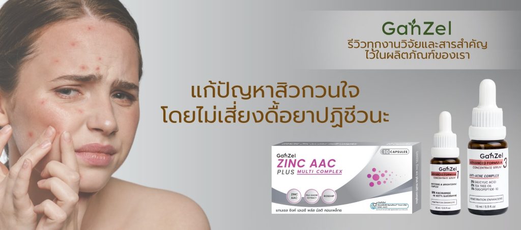 สิว zinc รักษาสิว